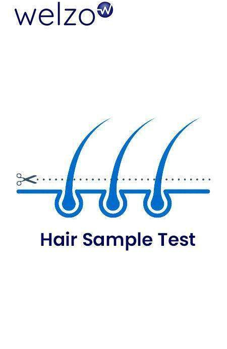 food-intolerance-test-welzo-3